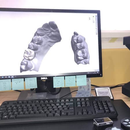 歯科技工所の写真