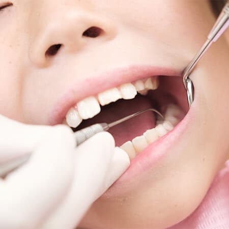 一般歯科 虫歯 歯周病 スマイルデンタルファミリー 豊中市 桃山台駅の歯医者